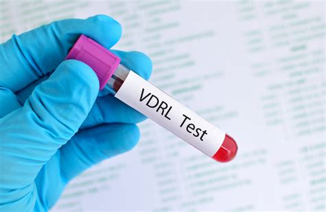 Understanding VDRL Test: Screening for Syphilis .